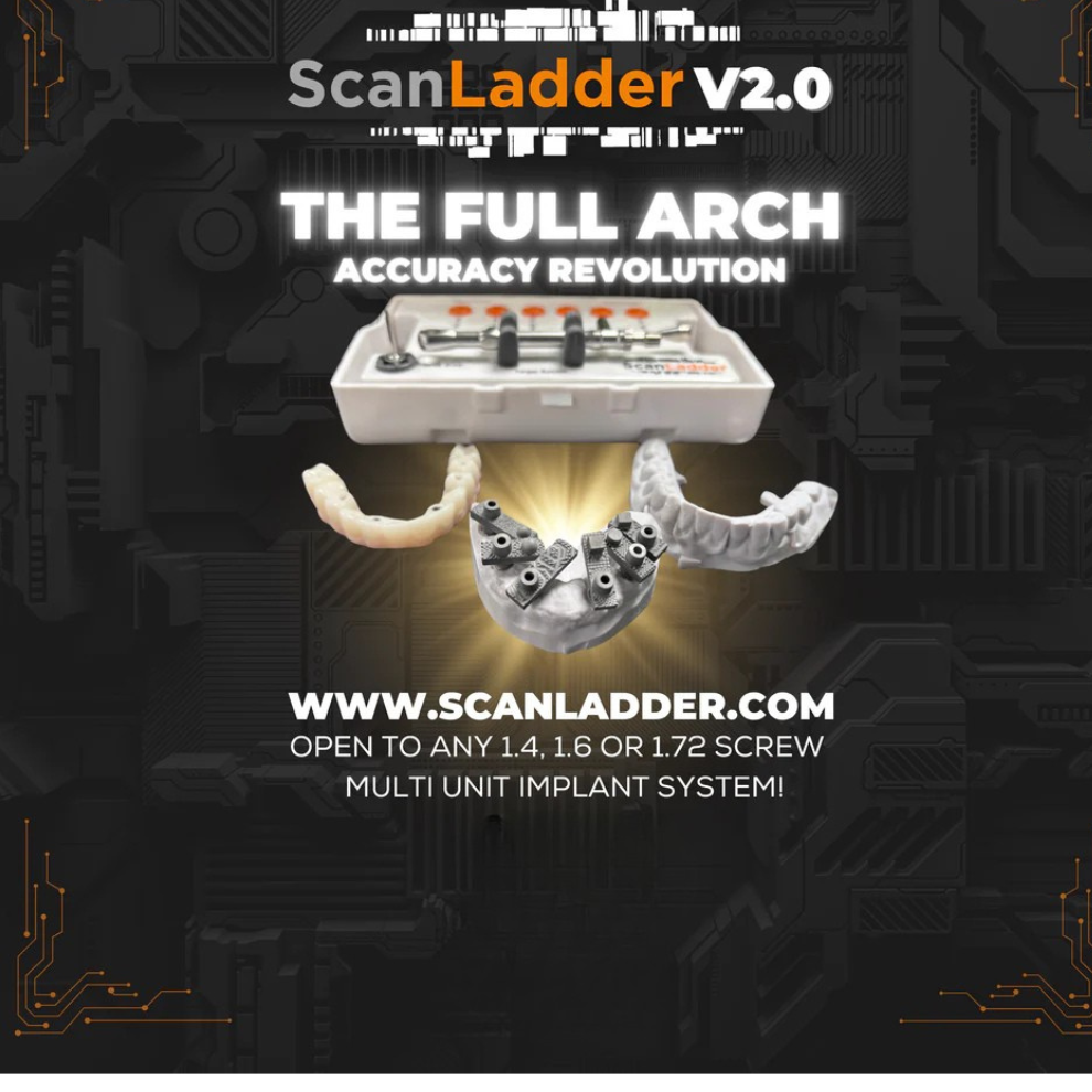 ScanLadder v2.0 Kit